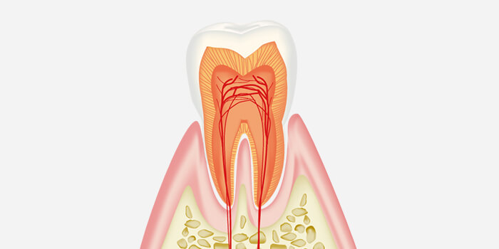 C0：再石灰化が期待できる初期の虫歯