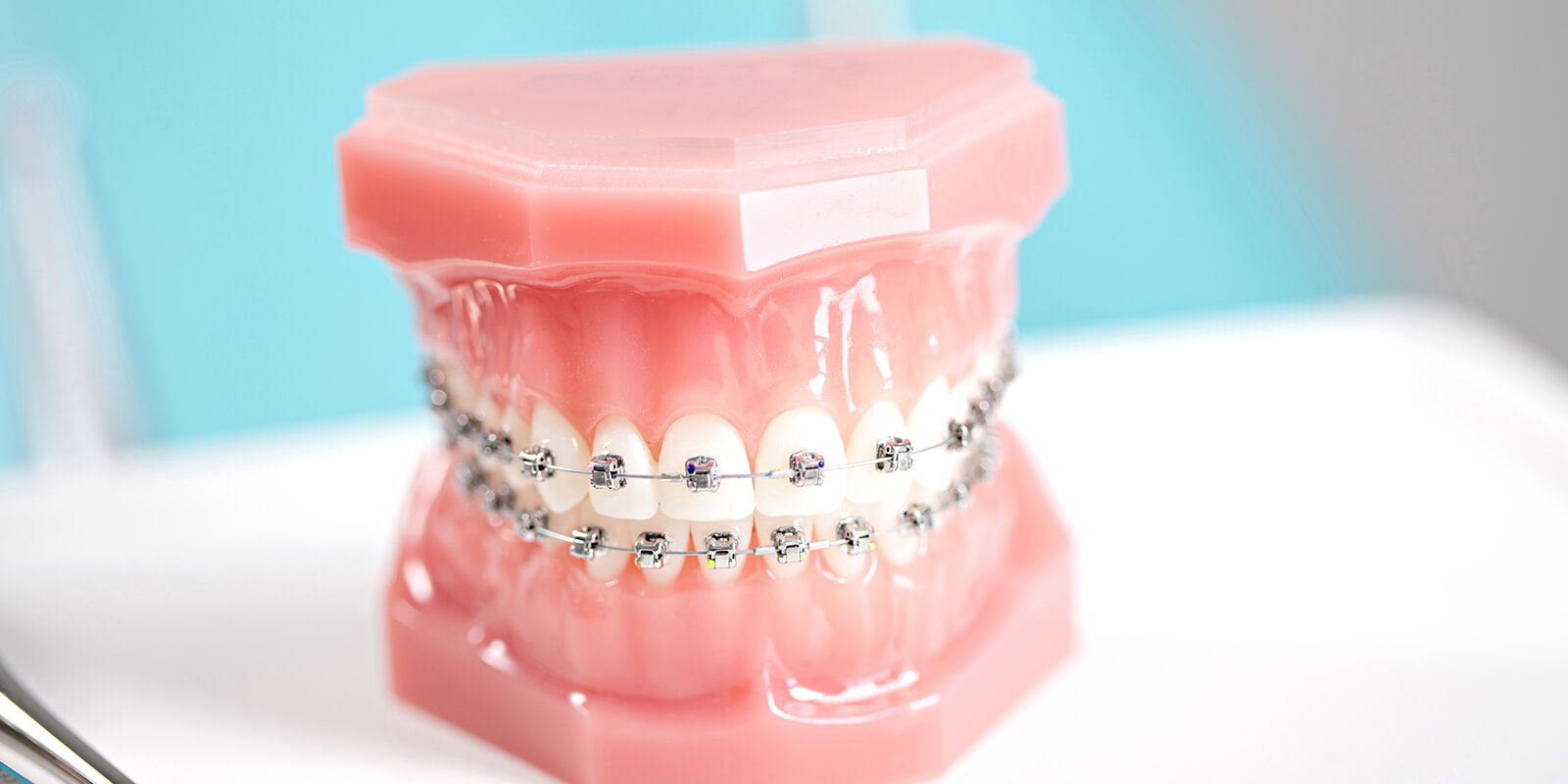 歯並びの矯正について